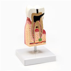 Макет "Строение зуба в разрезе" 13*6см