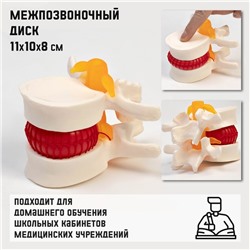 Макет "Межпозвонковый диск" 11*10*8см