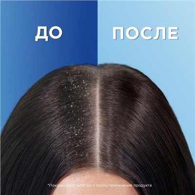 Шампунь против перхоти Head & Shoulders "Яблочная свежесть", 400 мл